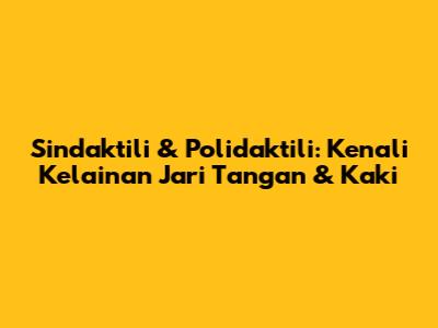 Sindaktili & Polidaktili: Kenali Kelainan Jari Tangan & Kaki