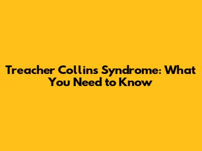 Treacher Collins Syndrome: What You Need to Know